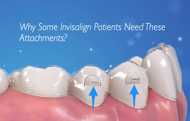 Invisalign Attachments Explained: how they work to help with your