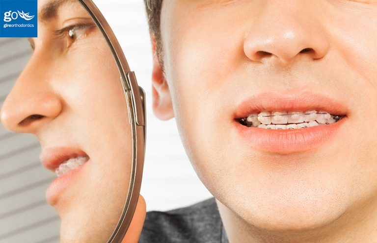 orthodontic invisible gire orthodontics