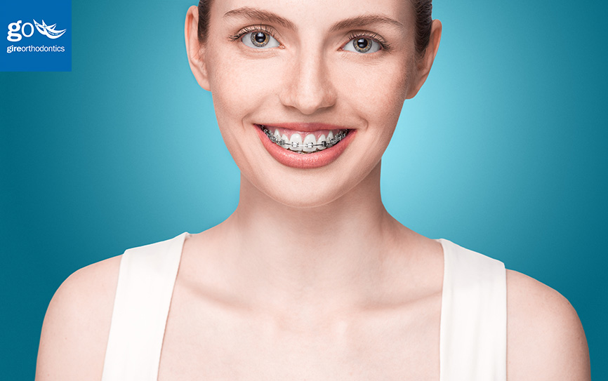 What is the cost of braces and Invisalign in La Habra and Chino Hills, CA?