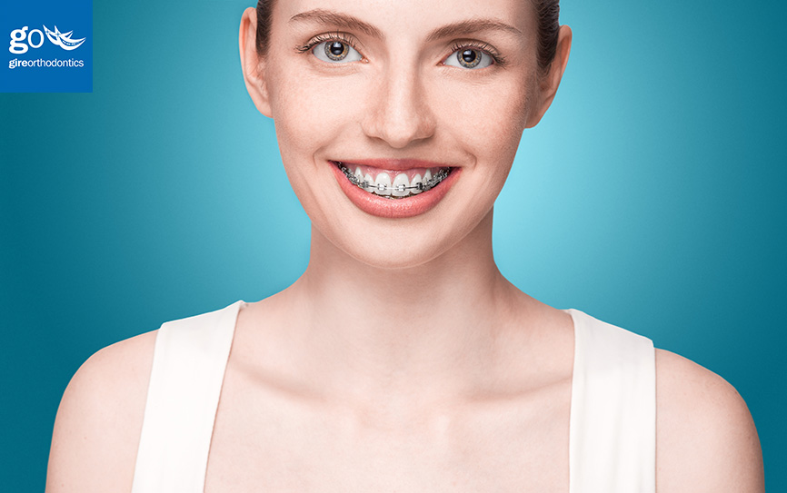 What's the cost difference between traditional braces and Invisalign? «  Smiles by White