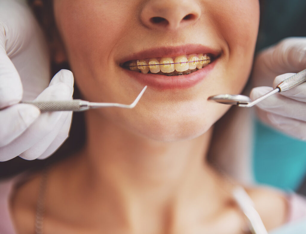 Regular Dental Check ups 1024x785